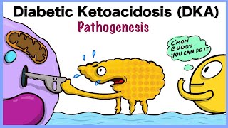 Diabetic Ketoacidosis DKA Pathogenesis [upl. by Eyla11]