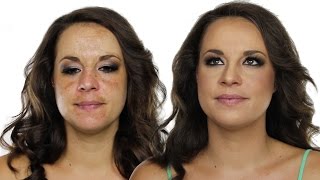 How To Cover Hyperpigmentation  Skin Pigmentation Using MakeUp  Shonagh Scott  ShowMe MakeUp [upl. by Tra]