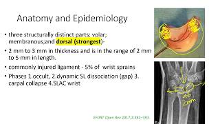 Ligaments of the Hand [upl. by Nosna]