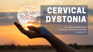 Cervical Dystonia Spasmodic Torticollis New Treatment Dr Demerjian TMJCONNECTION Case 13 [upl. by Yentiw298]