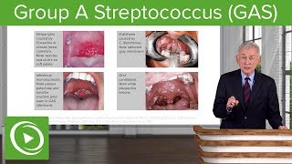 Group A Streptococcus GAS – Infectious Diseases  Lecturio [upl. by Soracco612]