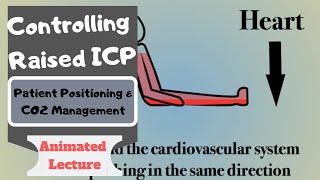 Combating Raised ICP video 1 Patient Positioning and CO2 Management [upl. by Akina]