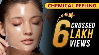 Chemical Peeling Before amp After  Procedure  Benefits  Dr Jagdish Sakhiya  Sakhiya Skin Clinic [upl. by Chara]