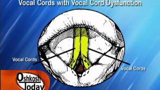 Lecture 6  LV Diastolic Function [upl. by Nahsab]