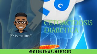 CETOACIDOSIS DIABÉTICA  CONCEPTOS BÁSICOS [upl. by Bala608]