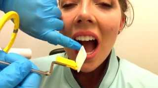 How to Take Periapical Radiographs [upl. by Samella523]