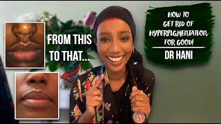 How To Get Rid Of Hyperpigmentation  Dr Hani [upl. by Nafri]