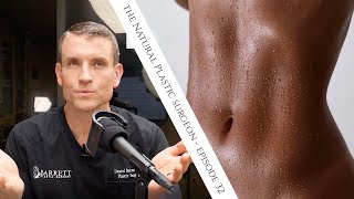 32 Everything You Need To Know About Liposuction [upl. by Ardnassac493]