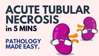 Acute Tubular Necrosis in 5 Minutes l Pathology Made Easy [upl. by Ormond606]