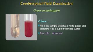 Cerebrospinal Fluid Examination CSF [upl. by Ellezig]