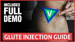 All You Need To Know About Joint Injections [upl. by Anaoj]