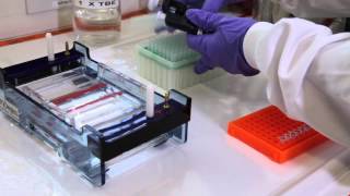 How to run an agarose gel [upl. by Adiell960]