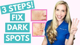 Fix Your Dark Spots in 3 Steps  Hyperpigmentation  Melasma  Skincare Made Simple [upl. by Rozella]