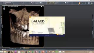 Sidexis 4  How to open Galaxis Galileos Implant Planning Software [upl. by Torrin982]