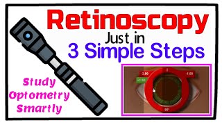 Retinoscopy in 3 Simple Steps [upl. by Primrose]