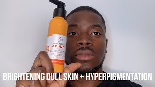 HOW I GOT RID OF DARK SPOTS BRIGHTEN DULL SKIN  HYPERPIGMENTATION [upl. by Cann]