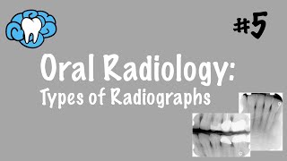 Oral Radiology  Types of Radiographs  INBDE ADAT [upl. by Elsa]