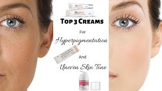 Top 3 Creams For Hyperpigmentation Uneven Skin Tone and Dull Skin  Rabia Skin Care [upl. by Annasus]