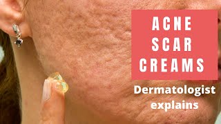 Acne Scar Creams  Dermatologist Reviews [upl. by Anette]