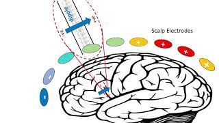 EEG  Electrical Brainwaves [upl. by Akinnor854]