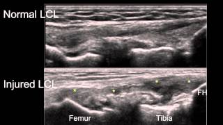 Anatomy of the Knee Joint [upl. by Snilloc]