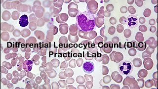 Differential Leucocyte Count DLC Practical Lab [upl. by Sldney]