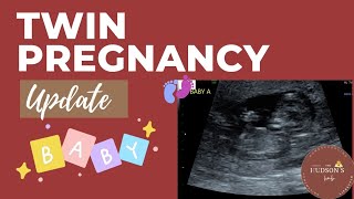 Twin Pregnancy Update [upl. by Annirok]