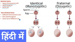 Types of Twins in Hindi [upl. by Aidua]