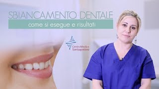 Sbiancamento dentale  come si esegue e risultati [upl. by Noyahs]