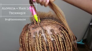 NEW TECHNIQUE ALOPECIA  HAIR LOSS BOX BRAIDS  IRENESBRAIDS [upl. by Winnie]