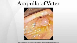 Ampulla of Vater [upl. by Gard]