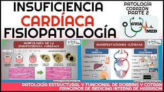 INSUFICIENCIA CARDÍACA FISIOPATOLOGÍA  GuiaMed [upl. by Peggir]