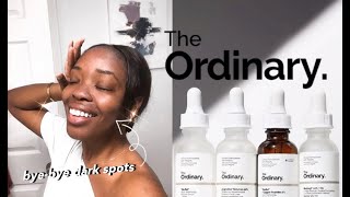 The Ordinary  5 BEST Products for Hyperpigmentation Dark Spots Oily  AcneProne Skin 2020 [upl. by Gottwald317]