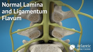 Scapholunate Ligament Injuries [upl. by Car658]