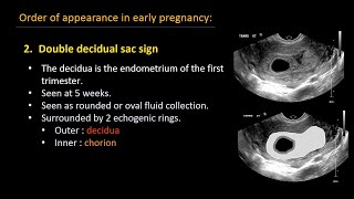 Ultrasound of normal early pregnancy [upl. by Sergias]