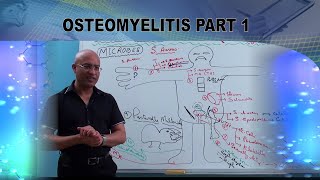 Osteomyelitis  Causes amp Symptoms  Bone Infection🩺 [upl. by Goldston]