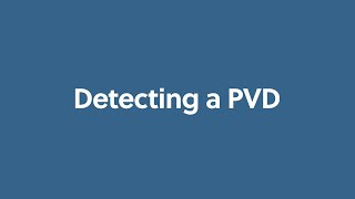 Detecting a PVD [upl. by Richardson]