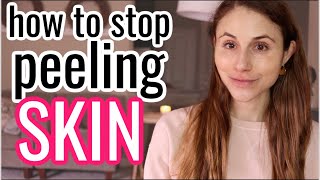 How to STOP PEELING SKIN Dr Dray [upl. by Tad]