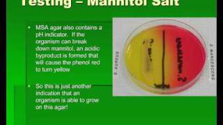 Introduction to Streptococcus [upl. by Kati]