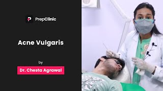 Acne Vulgaris  Dr Chesta Agrawal  Dermatology PrepClinic [upl. by Fritze]