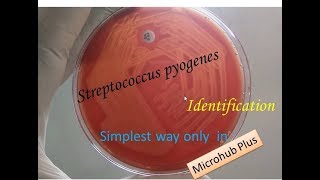 Streptococcus pyogenes identification [upl. by Lennon]