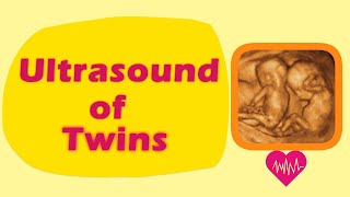 Sonography of Twins [upl. by Anemij]