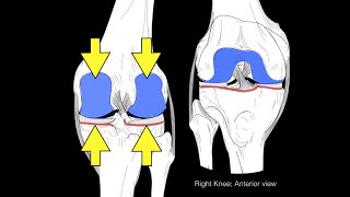 What is Ligament injury  Dr Illavarsan [upl. by Inaluahek]