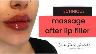 Lip Filler Massage and how to fix Bumps [upl. by Ynwat]