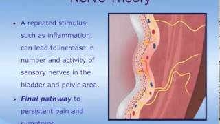 Understanding Interstitial Cystitis ICPainful Bladder Syndrome PBS [upl. by Hyacinth]