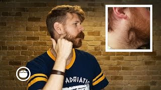 How To Deal With Beard Cowlicks [upl. by Fonseca337]