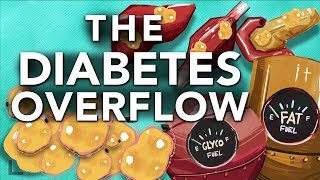 Obesity amp Diabetes Explained The Overflow Phenomenon [upl. by Elbertina]