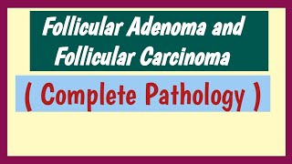 Craniopharyngioma Quick review  Pathology USMLE Step 1 [upl. by Risa]