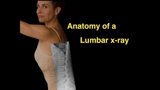 Anatomy of a Lumbar xray [upl. by Otrebla490]