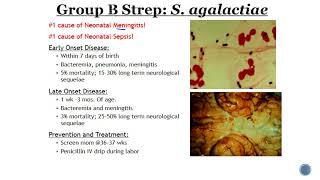 Group B Streptococcus GBS [upl. by Aicemat]